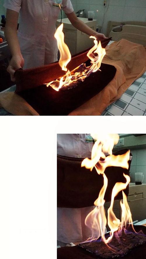 火龙灸视频,传统养生秘法的现代演绎